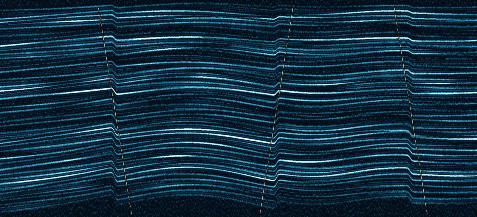 Interpreted seismic section showing a faulted anticlinal closure